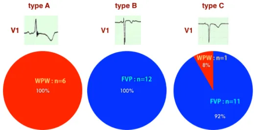 Fig.   8   Holter ECGs of a patient with WPW