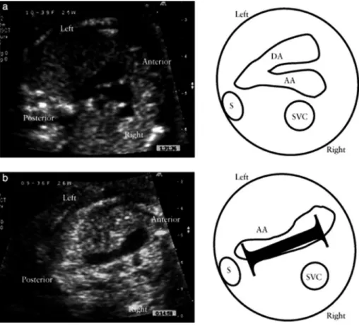 Fig.   2   I-shaped sign