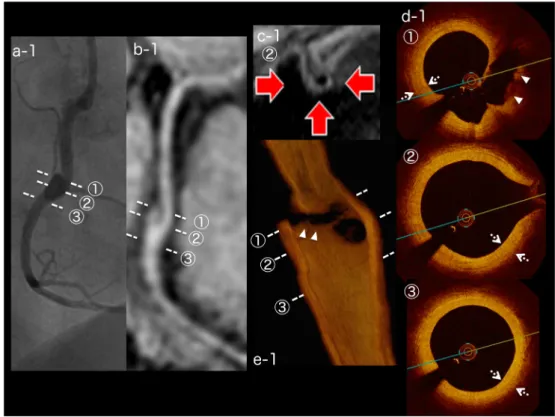 Fig.   1   Image ﬁndings for Case 1