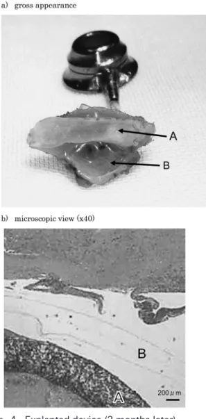 Fig.   4   Explanted device (3 months later)