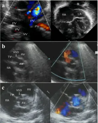 Fig.   1   Transthoracic echocardiography