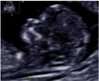 Table   1   Check points in the first trimester