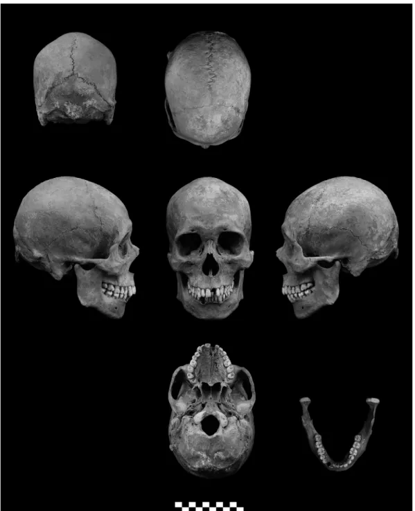 Fig.  1.  Photographs of the skull of No. 583.