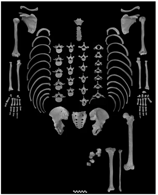 Fig.  2.  Photographs of the postcranial bones of No. 583.