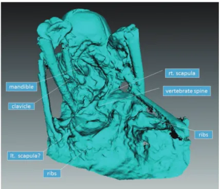 Figure 4-4.  Surface scan of M26 (posterolateral view).