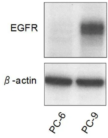 図 11 EGFR のウエスタンブロット法による解析