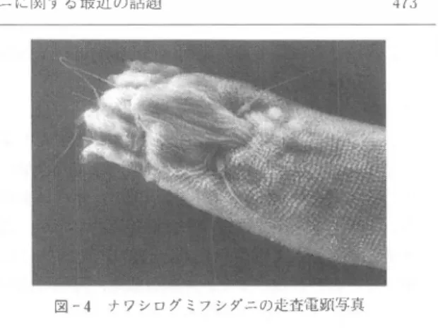 図 - 4 ブ ワ シ ロ グ ミ フ シ ダ ニ の 走査Hì顕写真