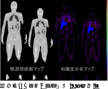 図 5  デジタルファントム(左:男性，右:女 性)  ４．デジタルファントムを使ったシミュレ ーション実験    デジタルファントムの放射能濃度の設計 値を変化させることで，複数のファントム 実験条件を容易に比較することが可能であ る．図 6 は放射能濃度の心肝比を 100:100，100:60，100:20 としてデジタル ファントムモデルを作成し，モンテカルロ シミュレーションコード SIMIND を使 い，正面像を作成した結果である．また， 心肝比が 100:20 のデジタルファントムモ デルについ
