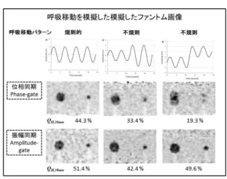 図 1 に異なる濃度比の集積を模擬した フ ァ ン ト ム 画 像 を 示 す ． 画 像 再 構 成 point-spread-function  (PSF)補正による Gibbs アーチファクトの影響を検討した 結果，濃度比が高いほど Gibbs アーチフ ァクトの影響が顕著となった 1) ．また，