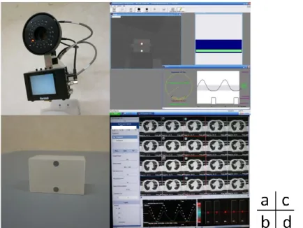 Figure 1    RPM の構成. (a)  赤外線 CCD カメラ, (b)  赤外線反射マーカー,    (c) RPM work station, (d) RPM work station
