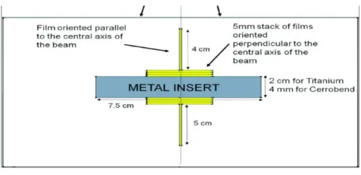 Fig. 2 Spine phantom( チタンロッド ) の線量分布と 4 つの測定点