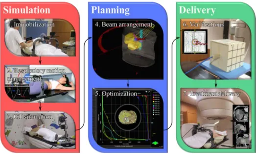 図 1  当院における SBRT ワークフロー  IIA)  Simulation  Simulation では固定具作成 ,  呼吸制御法の決定,  さらに治療計画用 CT 撮影を行う