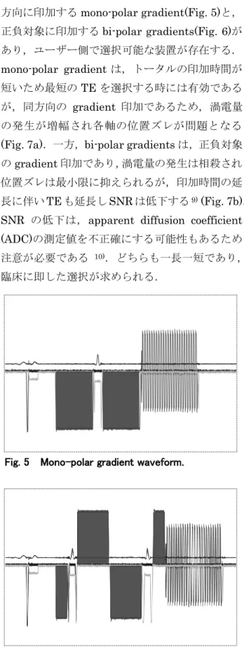 Fig. 6    Bi-polar gradients waveform. 