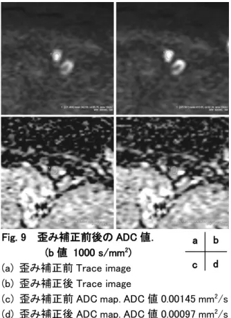 Fig. 10    ADC の manual 測定． 