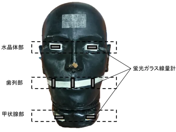 Fig. 3  Arrangement of the florescence glass detectors (FGDs) on the human body phantom of the  head and neck