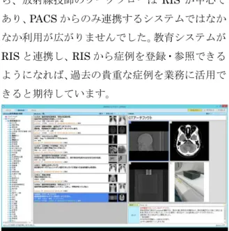 Fig. 3 ●今後の情報システムの展望についてお聞か せください  福井大学病院ではこれまでに蓄積した画像の 二次利用として、「教育システム」と呼ばれる画 像症例データベースを運用してきました（ Fig
