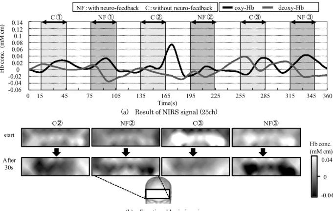 Fig. 7  Result of neuro-feedback training (first day) 