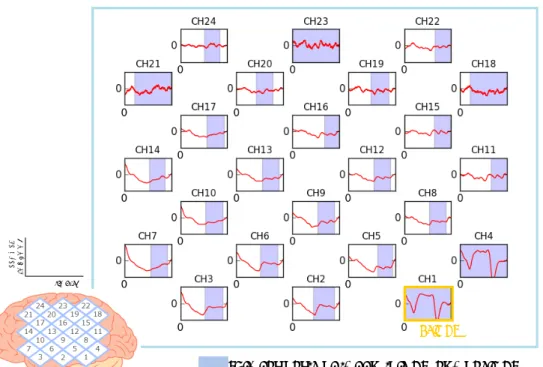 Fig. 10 CH1 と他の CH の類似部分