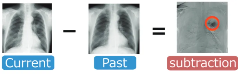 Fig. 1 病変部位強調のための経時差分処理 DICOM ・ patients information   name，address, sex，etc. ・ inspective information   modality, contrast medium, etc