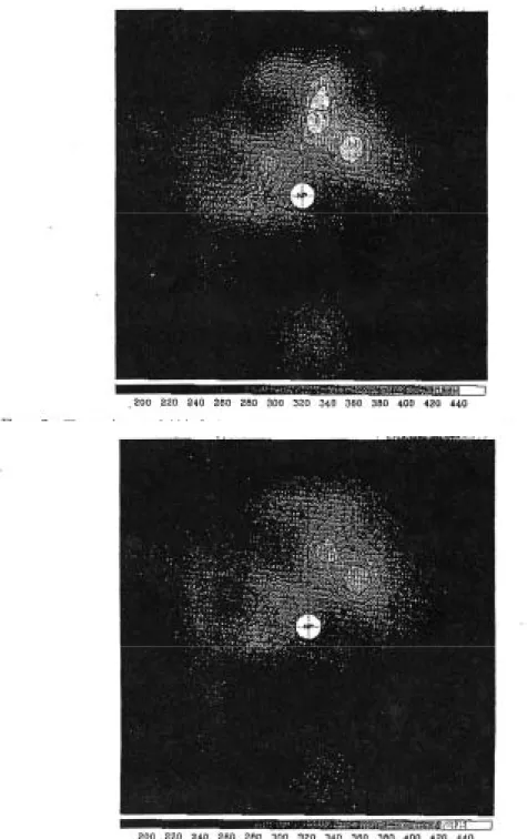 図 3.1.1-4  ELI 法によって作成した 1992 年 1 月 11 日のオゾン全量の分布［単位： Dobson］