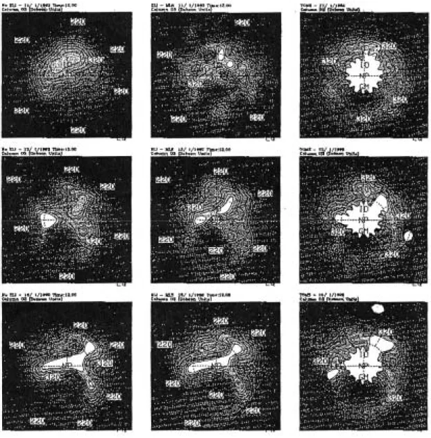 図 3.1.1-5 初期値の異なる 3 次元化学輸送モデルの計算結果の比較  左：東西方向に一様な初期値を与えたもの、中：ELI 法による初期値を 与えたもの、右：TOMS による観測値。  いずれも上段が 1 日後、中段が 2 日後、下段が 3 日後のオゾン分布（単 位：Dobson）。  （参考文献 1） 