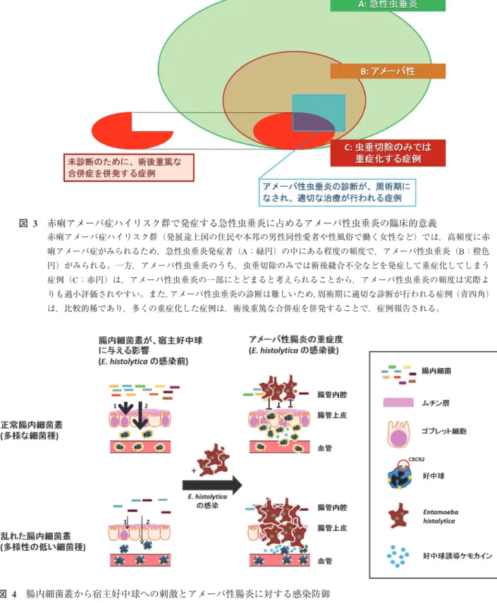 図   3　赤痢アメーバ症ハイリスク群で発症する急性虫垂炎に占めるアメーバ性虫垂炎の臨床的意義 赤痢アメーバ症ハイリスク群（発展途上国の住民や本邦の男性同性愛者や性風俗で働く女性など）では，高頻度に赤 痢アメーバ症がみられるため，急性虫垂炎発症者（A：緑円）の中にある程度の頻度で，アメーバ性虫垂炎（B：橙色 円）がみられる。一方，アメーバ性虫垂炎のうち，虫垂切除のみでは術後縫合不全などを発症して重症化してしまう 症例（C：赤円）は，アメーバ性虫垂炎の一部にとどまると考えられることから，アメーバ性虫垂炎の頻度