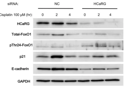 図 5. 尿細管上皮細胞(HK-2)にシスプラチン処理を行った際の Western blot 像。