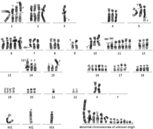 Fig. 2   Fluorescence in situ hybridization （ FISH ）法を 用いた転座の証明