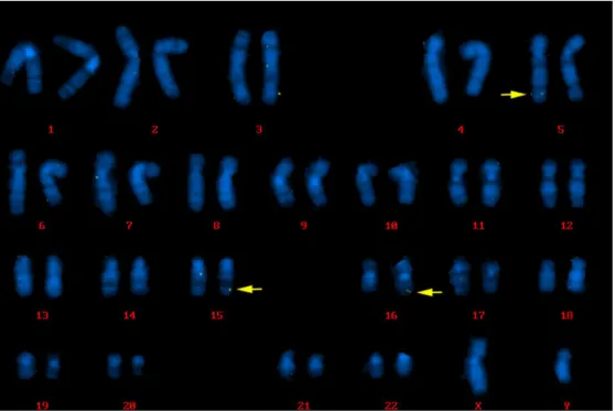 Fig. 1 HBs抗原陽性 Case 1   karyogram