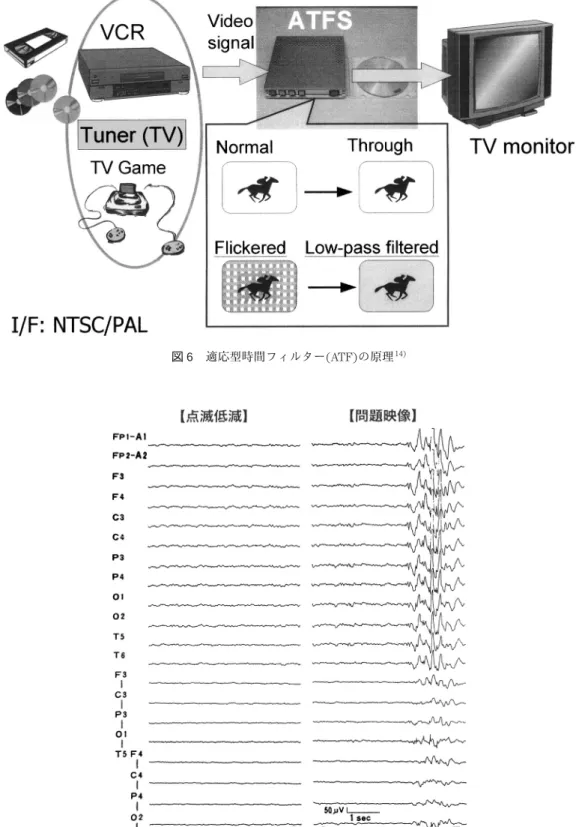 図 7 ATF による PPR 抑制効果［点滅低減］は装置作動下にて問題映像を提示，「問題映像」はその直接提示を 意味する 14) ．