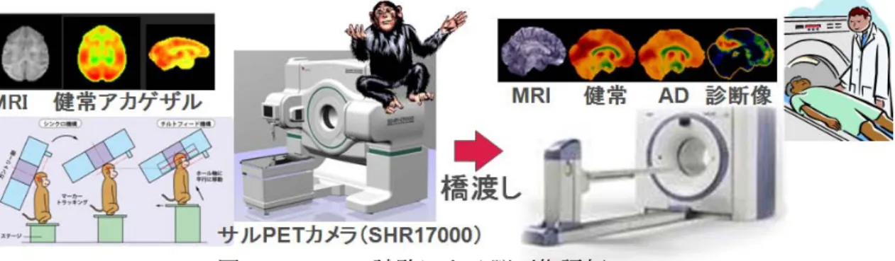 図 1. FDG-PET 試験による脳画像評価
