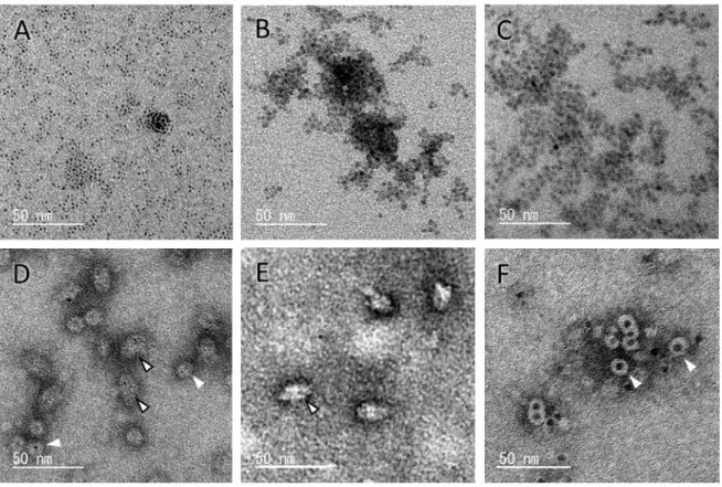 Fig. 8 TEM observation of EL/ES complexes including nanoparticles which variation  of the size and materials