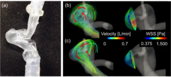 Fig. 2 Relationship between (a) coating number of silicone  and  wall  thickness (b)  wall  thickness  of  vessel  model  and deformation rate