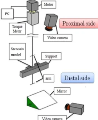 Fig. 1    Stenosis model. 