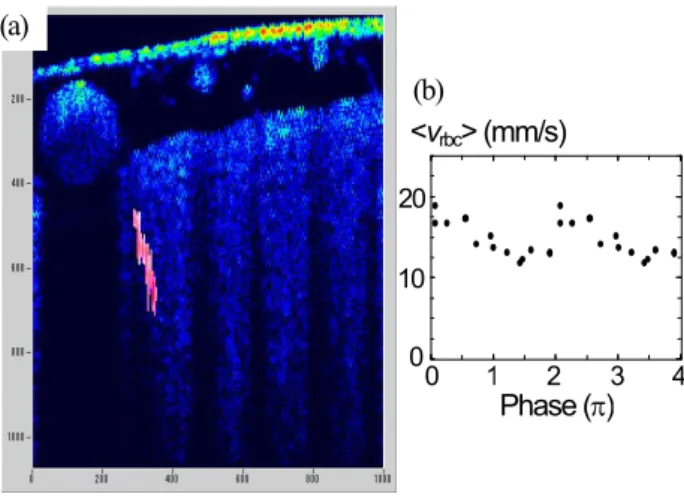 Fig. 1 (a) Velocity distribution in a penetrating arteriole shown in red is  superposed on the OCT structural image for the rat cerebral cortex (image  size: 1×1.07 mm) 11) 