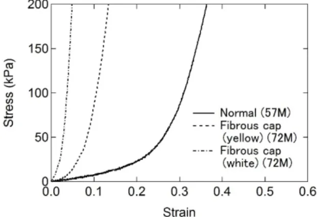 Fig. 1 Examples of the relationships between nominal  stress and nominal strain in the longitudinal direction  for strip-like specimens of human carotid arteries