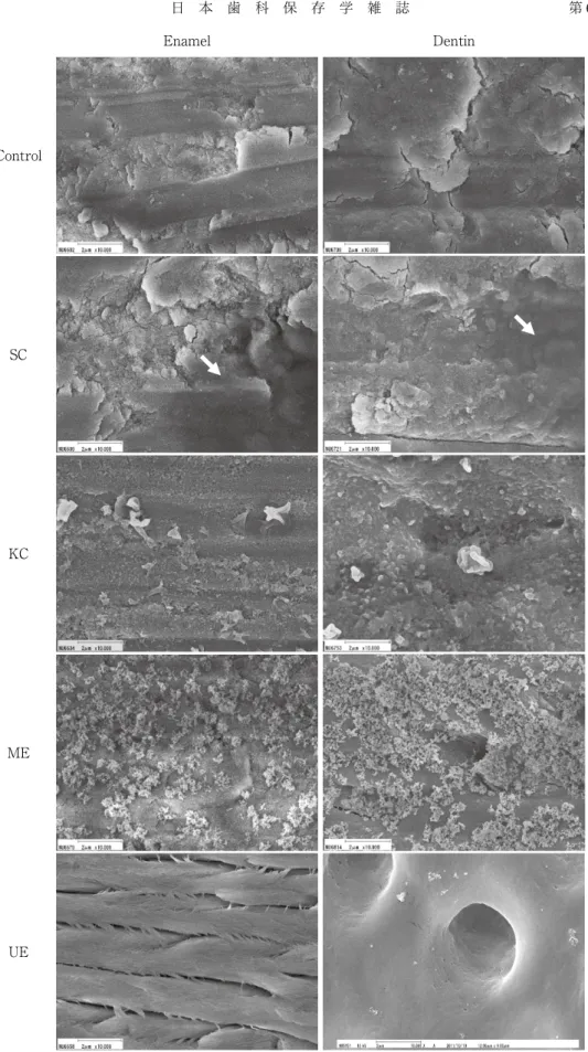 Fig.　2　SEM observation of saliva contaminated and surface treated tooth 　　　　　Arrows indicate the saliva contamination.
