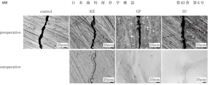 Fig.　5　SEM observation of enamel surface and longitudinal cross-sectional surface of enamel crack