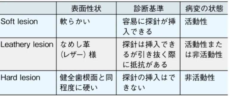 表 1　根面う蝕の臨床的分類 Soft lesion Leathery lesion Hard lesion 軟らかいなめし革 （レザー）様 健全歯根面と同 程度に硬い 容易に探針が挿入できる探針は挿入できるが引き抜く際に抵抗がある探針の挿入はできない 活動性 活動性または非活動性非活動性表面性状診断基準 病変の状態 図 1　初期活動性 　　　根面う蝕の例 参考文献 1）   歯科疾患実態調査報告解析検討委員会，編．解説 平成 17 年歯科疾患実態調査．東京： 口腔保健協会；2007．