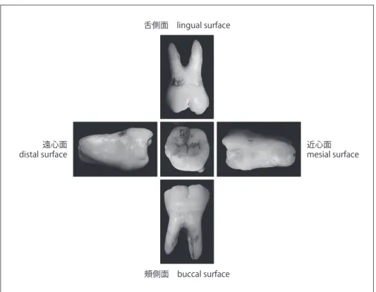 図 23　下顎右側第一大臼歯（permanent teeth）mandibular right first molar頰側面　buccal surface