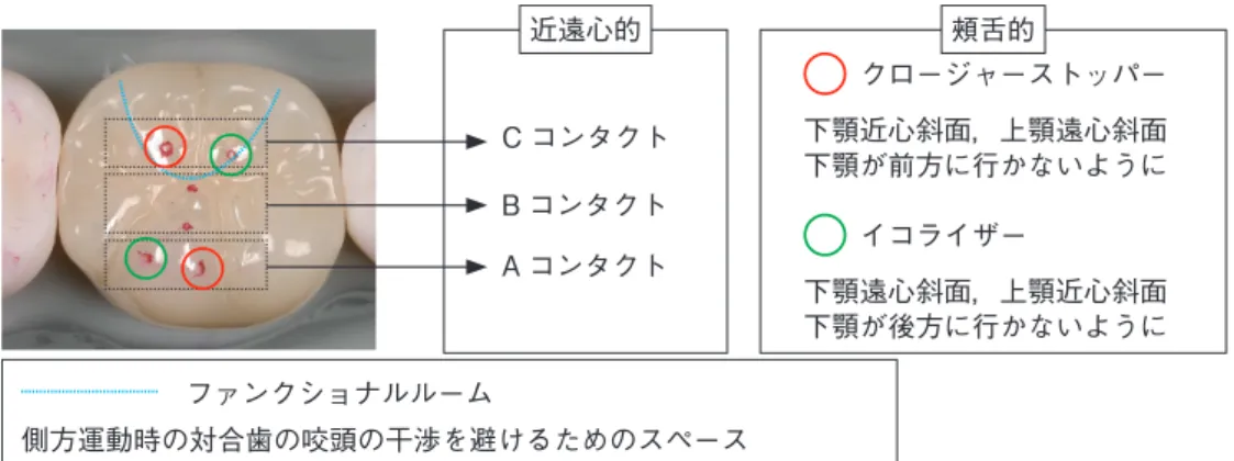 図 1　第一大臼歯の理想的な補綴装置の形態と咬合調整後の接触点C コンタクトB コンタクトA コンタクト　ファンクショナルルーム側方運動時の対合歯の咬頭の干渉を避けるためのスペース 　　クロージャーストッパー下顎近心斜面，上顎遠心斜面下顎が前方に行かないように　　イコライザー下顎遠心斜面，上顎近心斜面下顎が後方に行かないように近遠心的頰舌的 図 3-a 〜 c　最終補綴装置装着時a b c図 2-a 〜 g　36 歳女性．｜8 の抜去と下顎の補綴修復処置を希望し来院．a 〜 e：初診時口腔内．補綴を行う ６