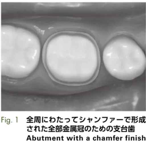 Fig.　1 全周にわたってシャンファーで形成
