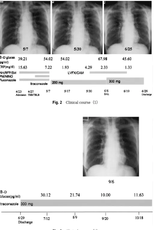 Fig. 3 Clinical course（2）