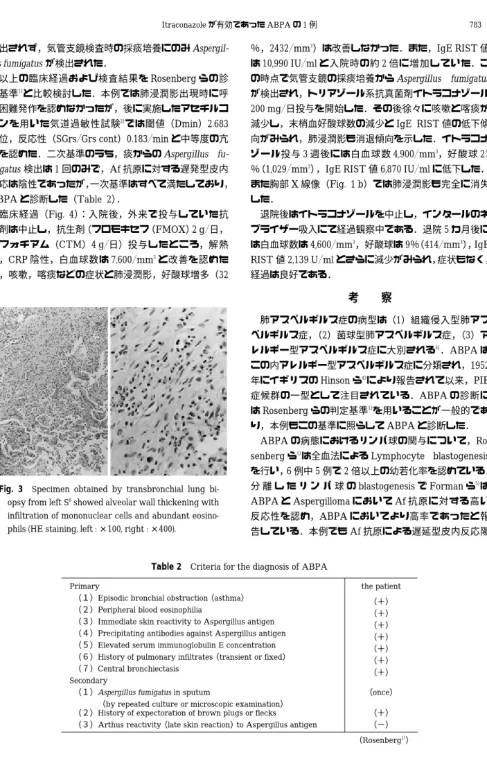 Table 2  Criteria for the diagnosis of ABPA the patientPrimary （＋） （＋） （＋） （＋） （＋） （＋） （＋）（１）  Episodic bronchial obstruction （asthma） （２）  Peripheral blood eosinophilia（３）  Immediate skin reactivity to Aspergillus antigen（４）  Precipitating antibodies agai