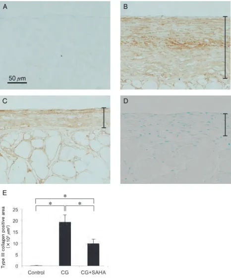 図 2　type III collagen の免疫組織化学的解析