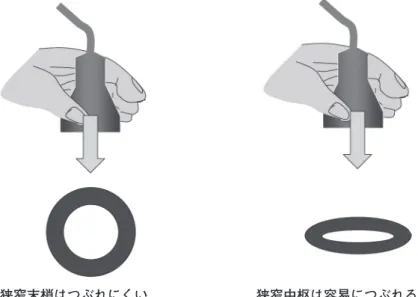 図 3a　超音波ガイド下シース挿入