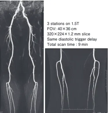 図 2　増大傾向を呈した多嚢胞腎に発生した透析腎癌2009 年CT2010 年MRI 2011 年CT2011 年MRI