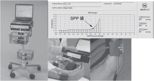 図 5　skin perfusion pressure（SPP）測定装置SPP 値