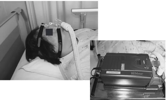 図 7 自動的経鼻式持続陽圧呼吸（AutoCPAP）