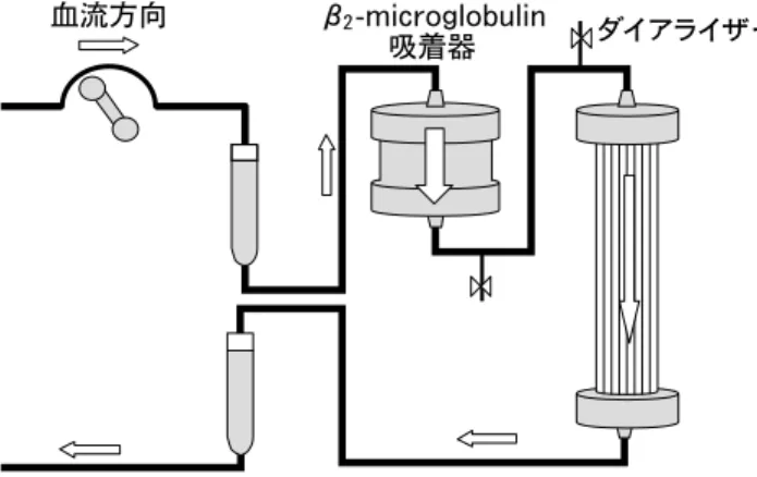 図 1 β 2 -mi crogl obul i n吸着器使用時の体外循環血液回路